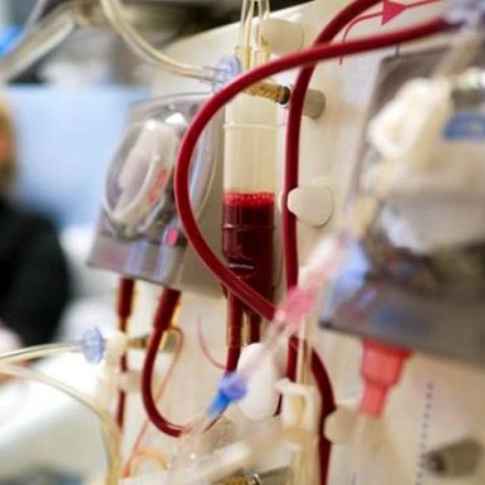 Κέντρα αιμοκάθαρσης