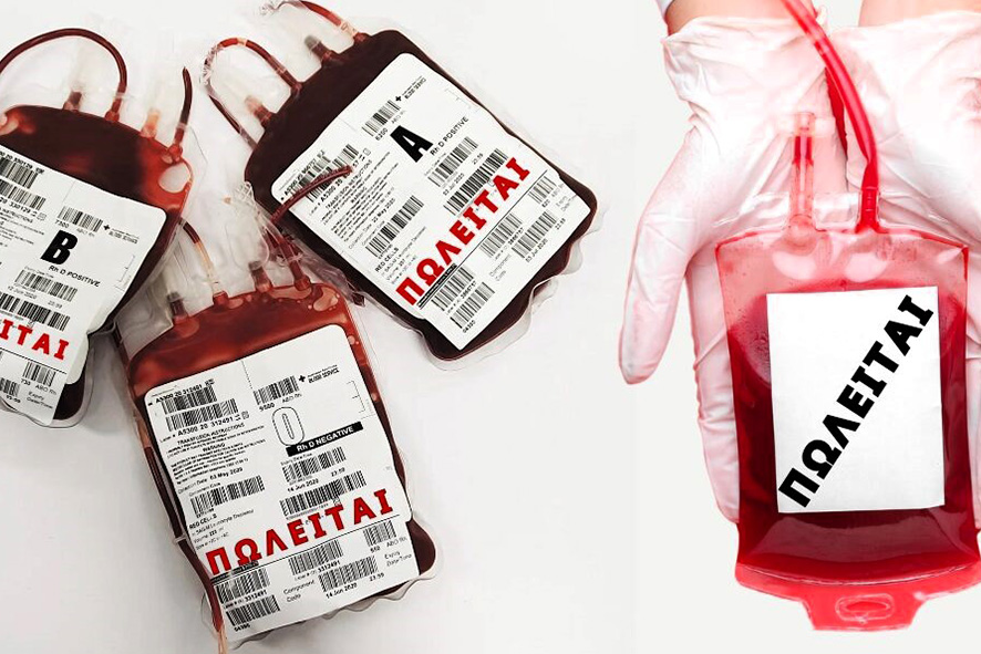 Η Ε.Σ.Α.μεΑ. στέκεται κατηγορηματικά αντίθετη στην εμπορευματοποίηση του αίματος!